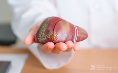 Casi el 40% de los pacientes con enfermedad inflamatoria intestinal presentaría acumulación patológica de grasa en el hígado